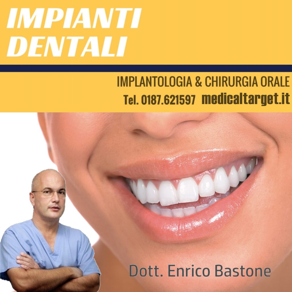 Cosa significa Implantologia Dentale