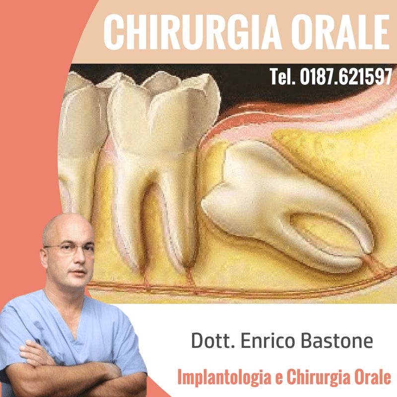 chirurgia orale