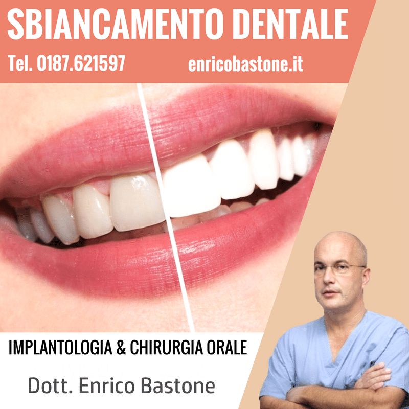 sbiancamento dentale sarzana