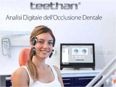 occlusione dentale